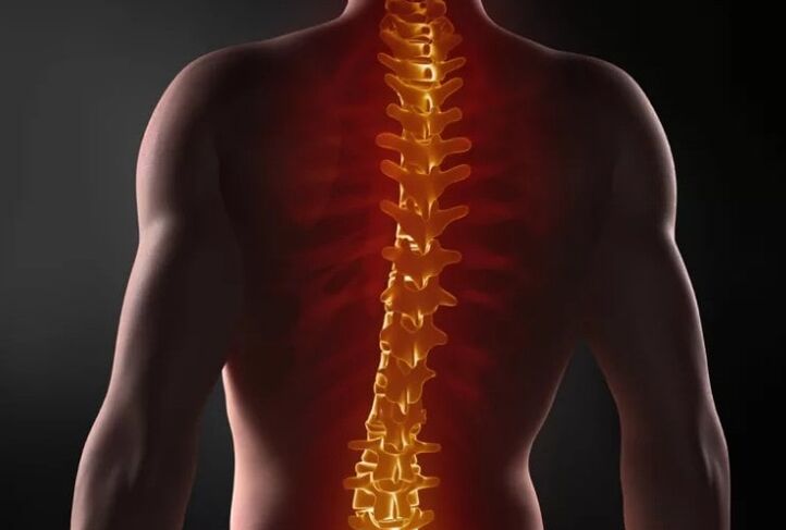 Osteocondritis an spine